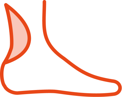 Ortézy na achillovu šlachu